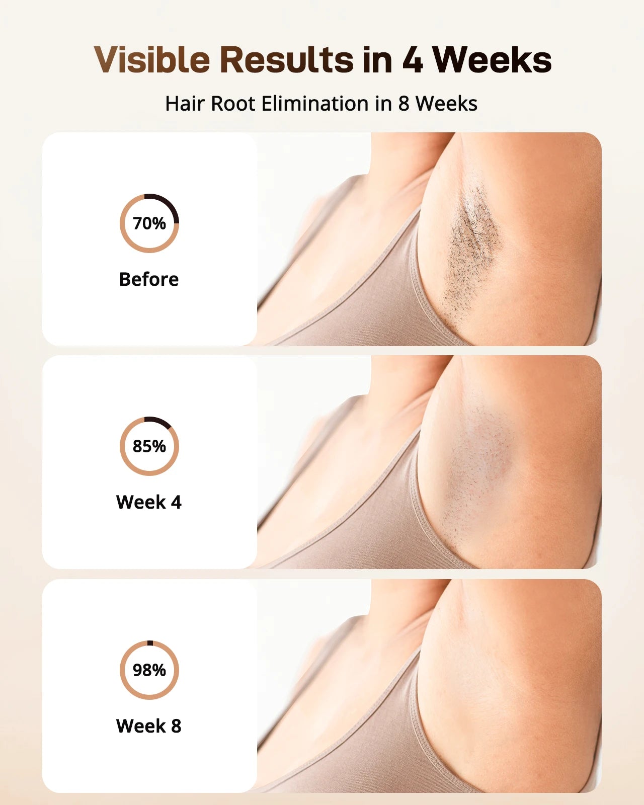 IPL Hair Removal Device Ice-Cooling 3 in 1 Painless 16J Photoepilator Permanent Whole Body Home Treament for Men and Women